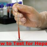 How to Test for Hepatitis?